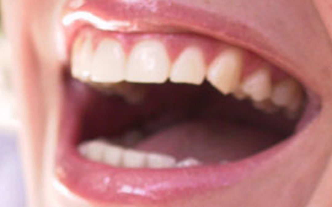 Co robić, aby mieć piękne, zdrowe zęby?